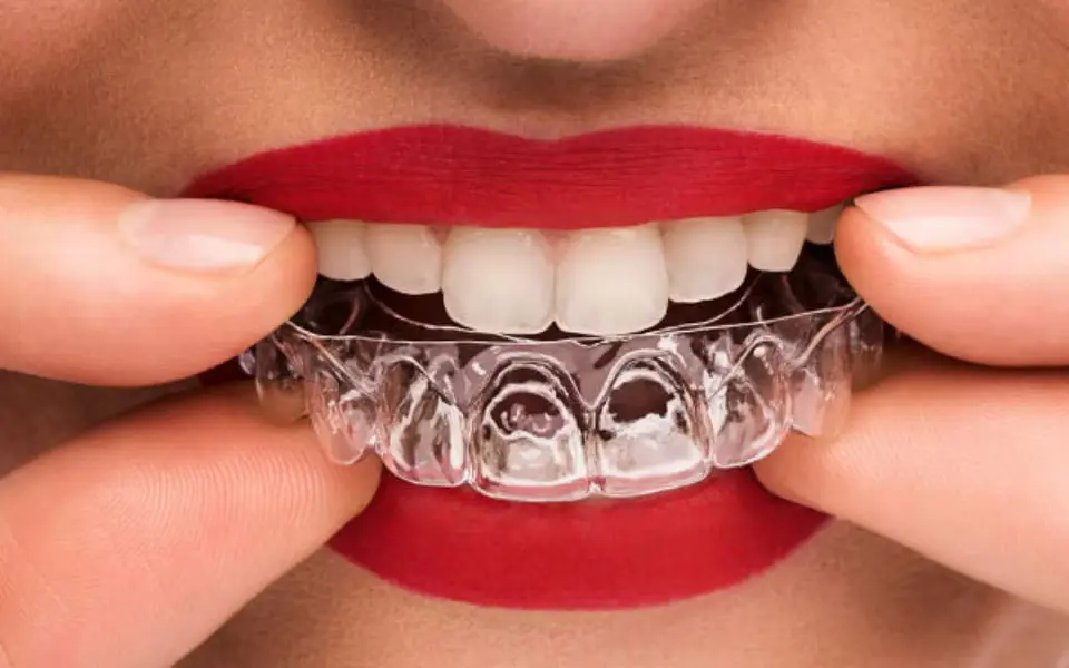 Druk 3D HP MJF w stomatologii – jak nowoczesna technologia zmienia produkcję modeli dentystycznych i nakładek ortodontycznych?